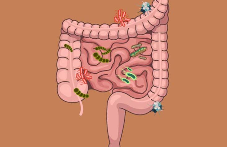 SIBO i nadmiar histaminy